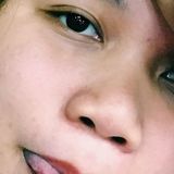 Yssa from Tarlac | Woman | 33 years old | Cancer