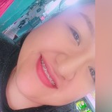 Lizbeth from Tampico | Woman | 28 years old | Cancer